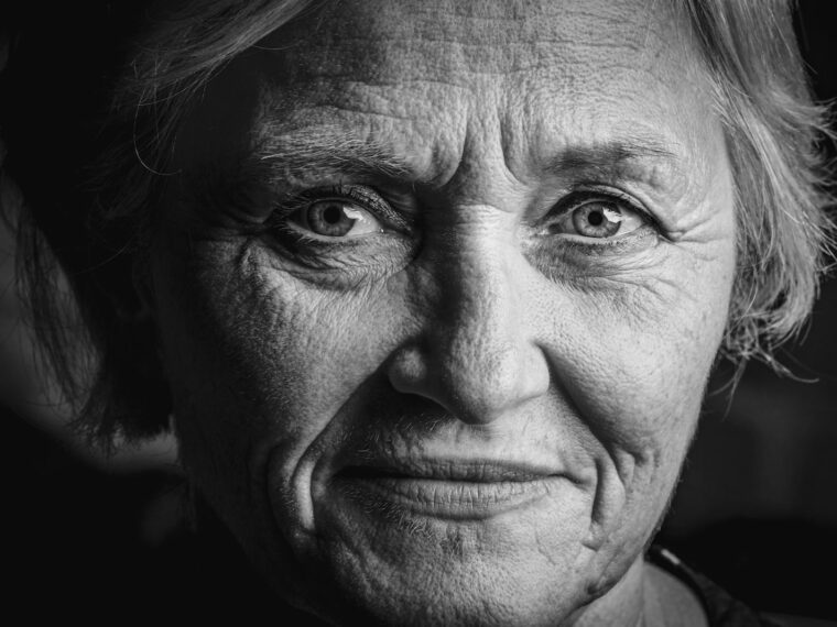 na czym polega Restylane Volyme?